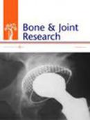 Bone & Joint Research